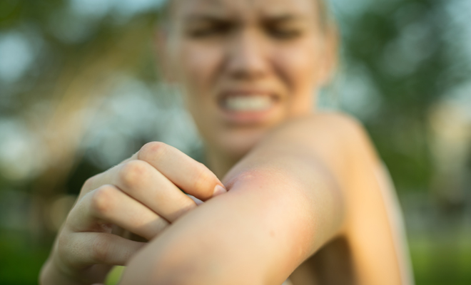 El significado de soñar con picaduras de mosquito