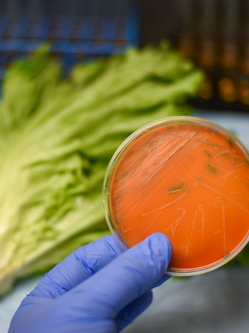 ¿Tengo listeriosis? Precauciones MUY importantes para evitar su contagio