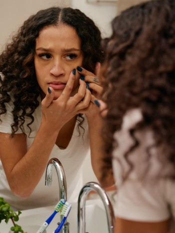 Relación entre el estrés y el acné: ¿cuál es el tratamiento más útil?