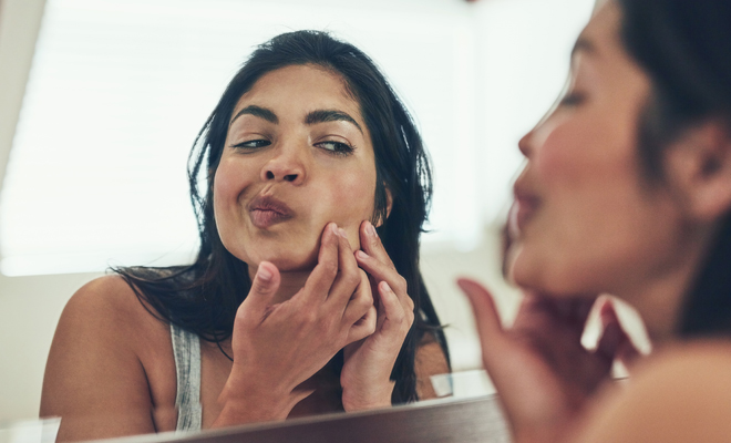 ¿Puede el estrés provocar acné?