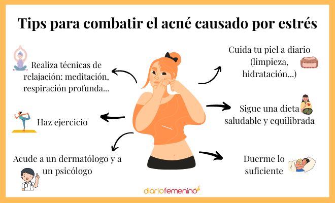 Formas de tratar el acné por estrés