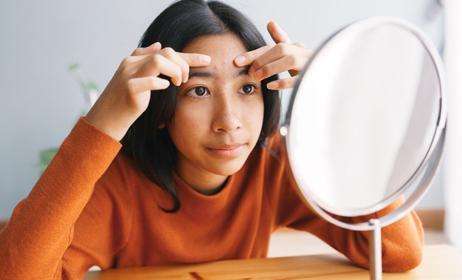 ¿Qué es exactamente el acné vulgar?