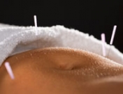 Acupuntura para el dolor de estómago y las dudas que genera