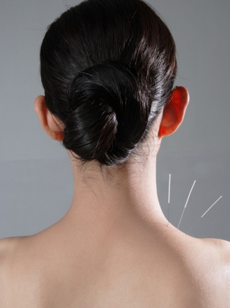 Acupuntura para el insomnio: una técnica milenaria para dormir hoy