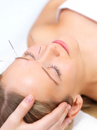 Cómo aliviar el estrés con acupuntura: ¿qué beneficios tienen las agujas?