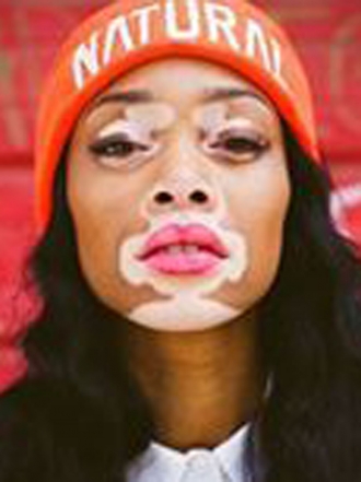 Chantelle Brown-Young: un rostro diferente en el mundo de la moda