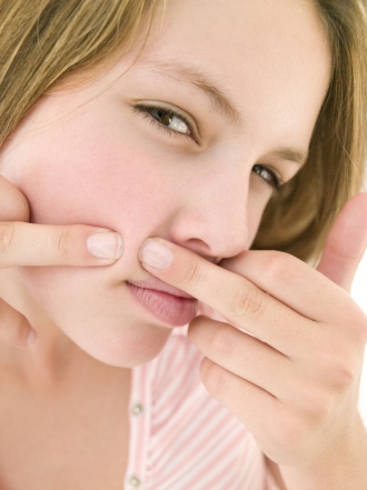 Remedios caseros para las espinillas: cómo eliminar el acné de forma natural