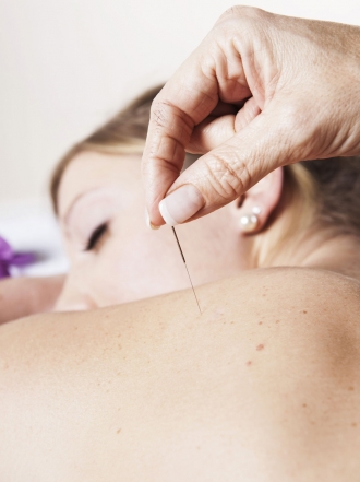 Cómo adelgazar con acupuntura, ¿funciona?
