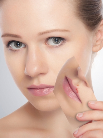 Síntomas y tratamiento para un herpes facial