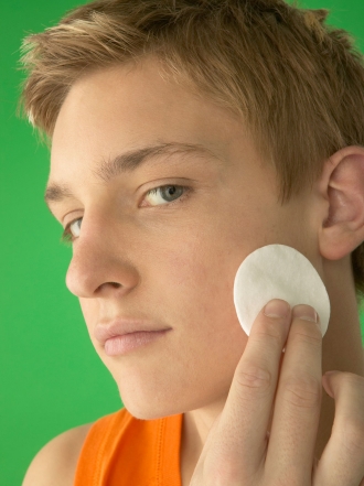 Acné juvenil: causas y tratamientos para los granos de la adolescencia