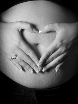 Remedios caseros para eliminar las estrías