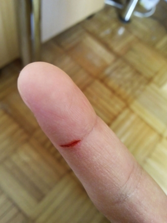 Remedios caseros para cicatrizar heridas