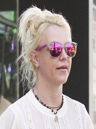 Situaciones que vivimos cuando tenemos un grano