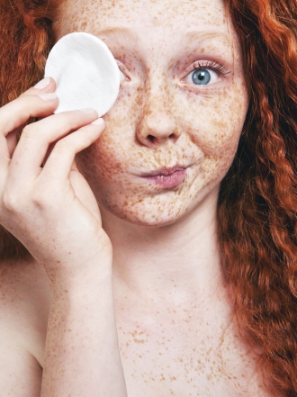 Remedios caseros para eliminar las pecas