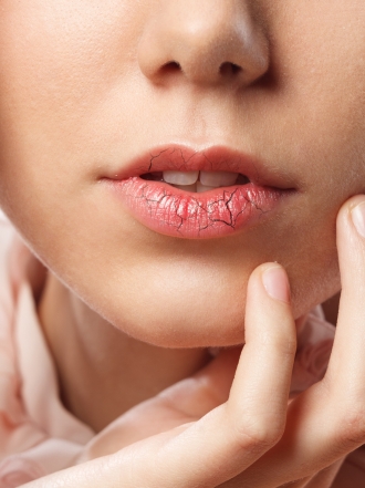 Por qué se resecan los labios