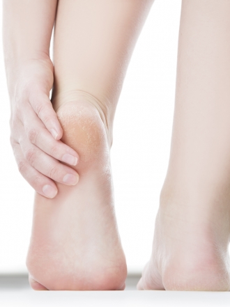 Grietas en los pies: remedios caseros para combatirlas