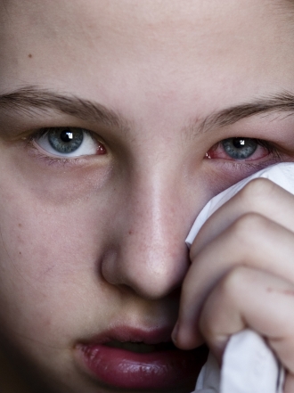 Conjuntivitis: qué es y tipos de conjuntivitis que hay