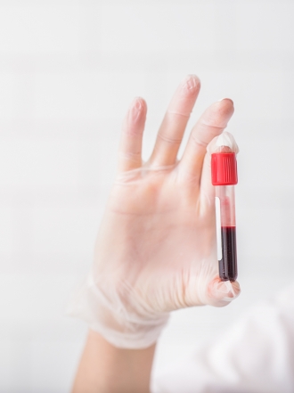 ¿Te desmayas cuando ves una gota de sangre? Tienes hematofobia