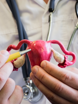 Cuál es el tratamiento para la endometriosis