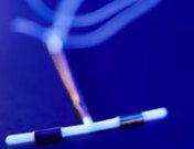 Qué es el DIU: ventajas y desventajas de este método anticonceptivo