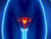 DIU de cobre, DIU hormonal y DIU Mirena