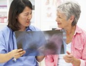 Cambios hormonales en el climaterio: qué sucede al llegar la menopausia