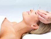 La acupuntura como método para aliviar los síntomas de la menopausia