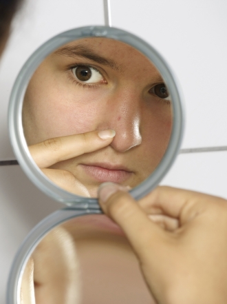 Acné por la regla: combate los granos y espinillas de la menstruación