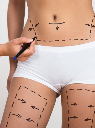 La primavera, el momento ideal para las operaciones de cirugía estética