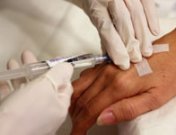 Menopausia inducida por quimioterapia o radioterapia