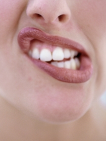 Bruxismo: rechinar los dientes inconscientemente