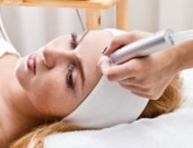 Tratamiento facial de peeling químico, ¿es efectivo?