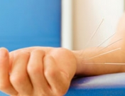 ¿Sirve la acupuntura para tratar la depresión?