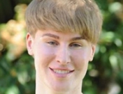 El clon de Justin Bieber: obsesión y cirugía para ser como su ídolo