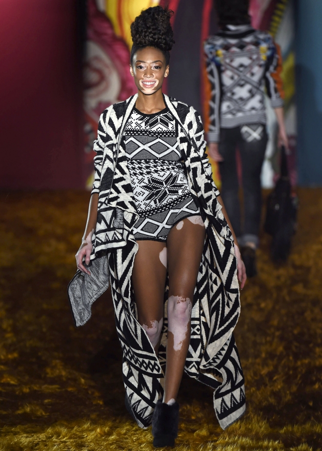 Desigual 2015: Winnie Harlow, espectacular para el desfile