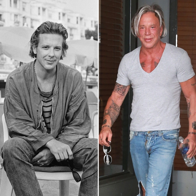 Famosos que envejecieron fatal: Mickey Rourke