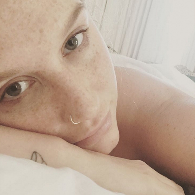 Famosas sin maquillar: las pecas de Kesha