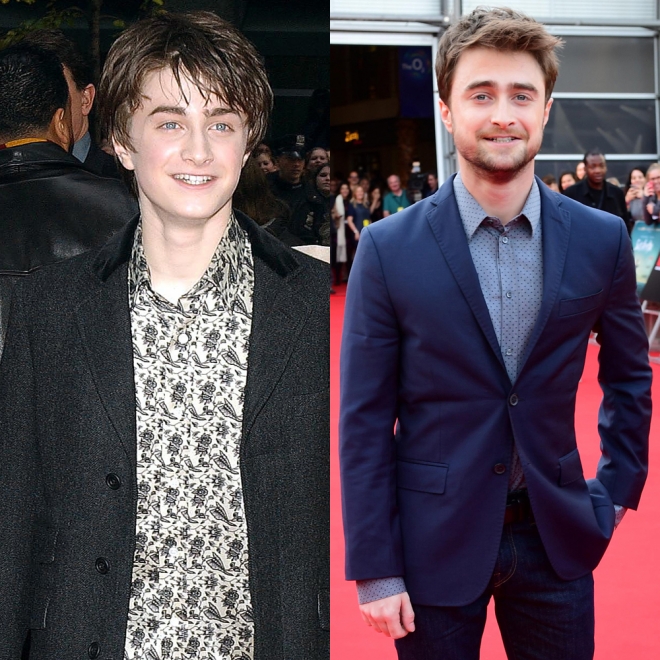 Daniel Radcliffe, eterno Harry Potter antes y después