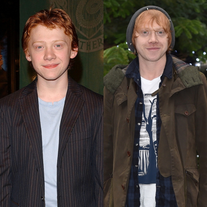Así era y así es hoy el actor que dio vida a Ron Weasley en Harry Potter