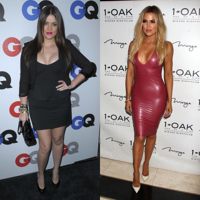 El antes y el después de Khloé Kardashian