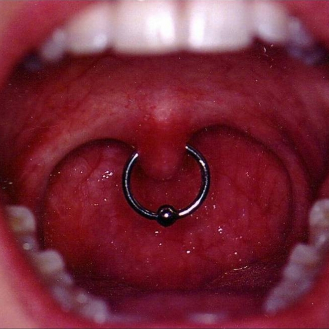 Piercings dolorosos: Piercing en la úvula