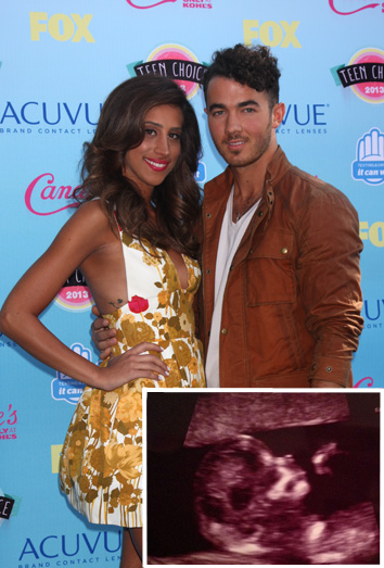 Kevin Jonas está feliz con la ecografía de su hijo, el nuevo miembro de los Jonas Brothers Kevin Jonas está feliz con la ecografía de su hijo, el nuevo miembro de los Jonas Brothers