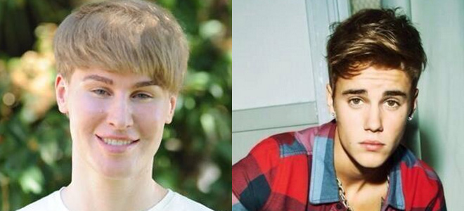 El fan de Justin Bieber que se ha operado para ser como él. El fan de Justin Bieber que se ha operado para ser como él.