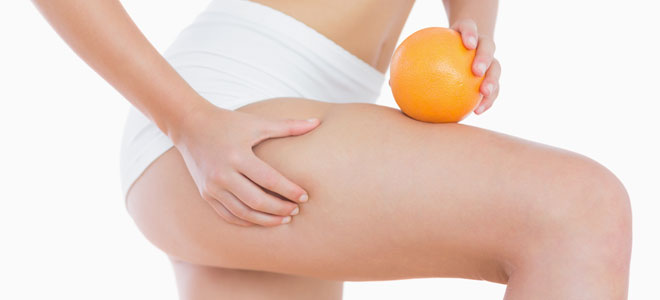 Cómo prevenir la celulitis