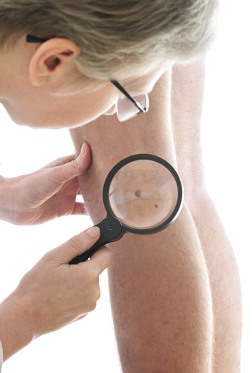 Enfermedad de Darier