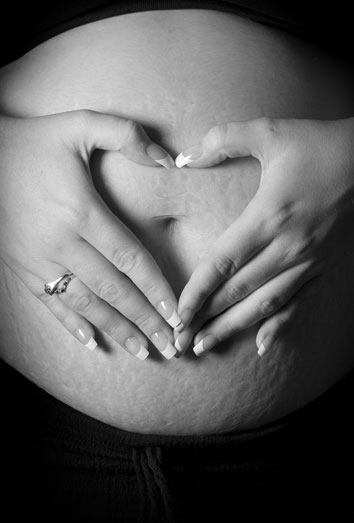 Remedios caseros para las estrías