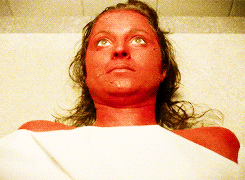 En cuanto menos te lo esperes, rojeces en la piel. En cuanto menos te lo esperes, rojeces en la piel.