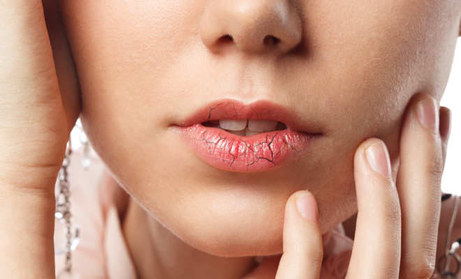 Por qué se resecan los labios
