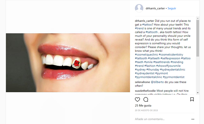 218604-tatteeth Tatteeth o tatuajes en los dientes