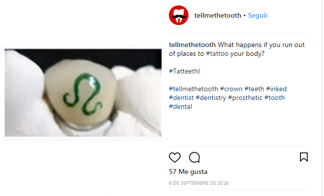 218604-tatteeth Tatteeth o tatuajes en los dientes